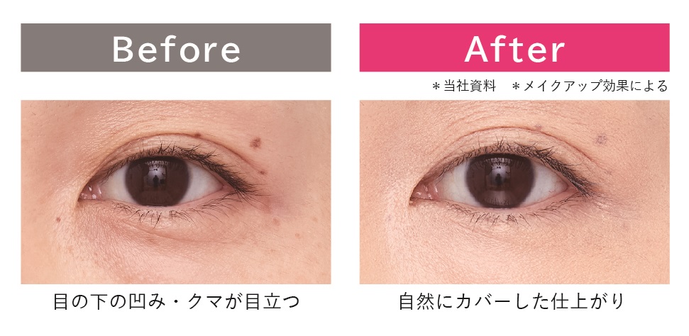 エクスボーテ　ブランド内NO.1※1！「薬用コンシーラー」 から 「クマ・くすみ」にフォーカスした待望の新色登場